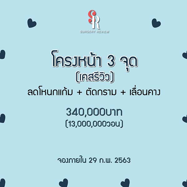 โครงหน้า 3 จุด ลดโหนกแก้ม ตัดกราม เลื่อนคาง สำหรับเคสรีวิว