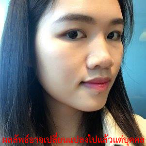 หน้า เรียว-เสริมจมูก-ศัลยกรรม-ศัลยกรรม ใบหน้า