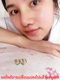 ศัลยกรรม-เสริมจมูกเกาหลี-เสริมจมูก-ทำ ศัลยกรรม