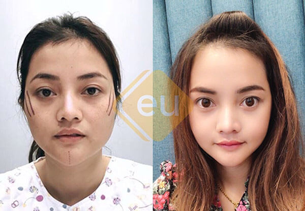 8 คลินิกศัลยกรรมยอดนิยม ของ คนเกาหลี ที่คุณต้องรู้ 2023 | Surgery Review