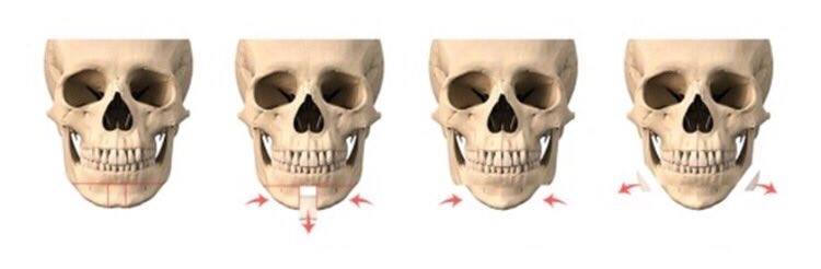 วีไลน์คืออะไร