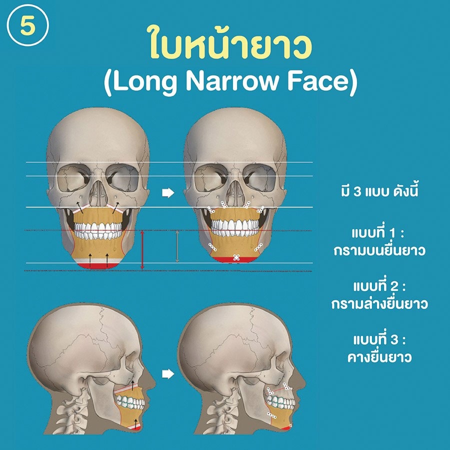ใบหน้ายาว Long Narrow Face