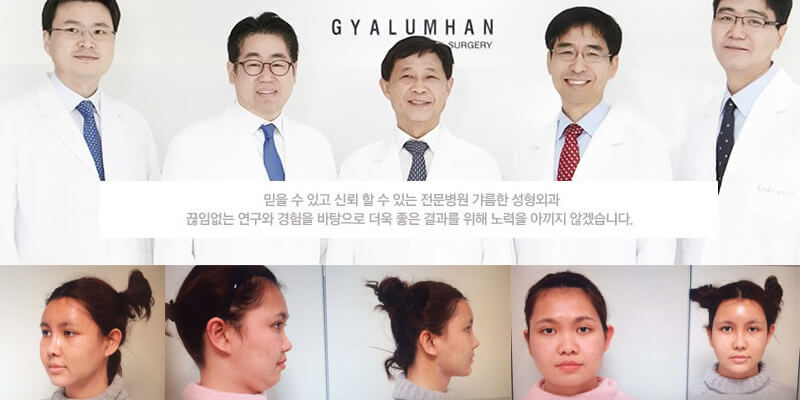 คลินิกฉีดไขมัน-ยอดนิยม-เกาหลี-Gyalumhan
