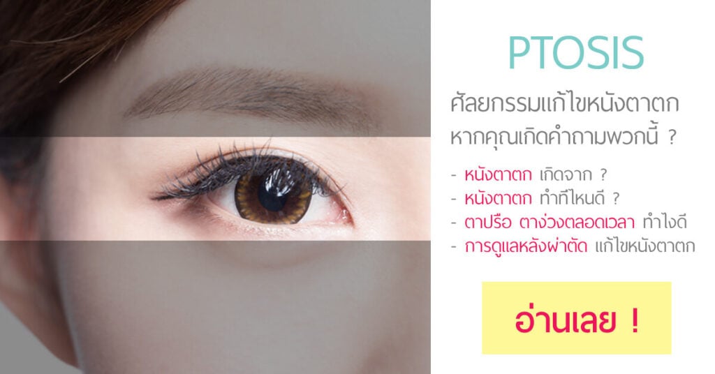 Ptosis คืออะไร แก้ตาปรือ ตาง่วงนอน ได้อย่างไร