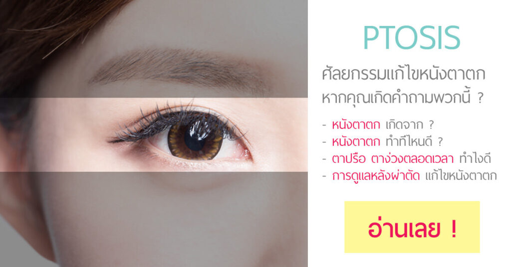 drops for ptosis
