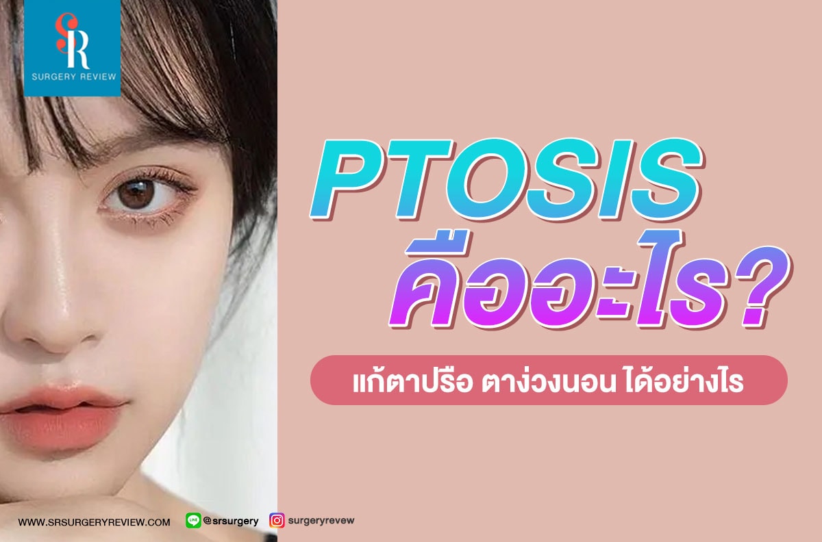 Ptosis คืออะไร