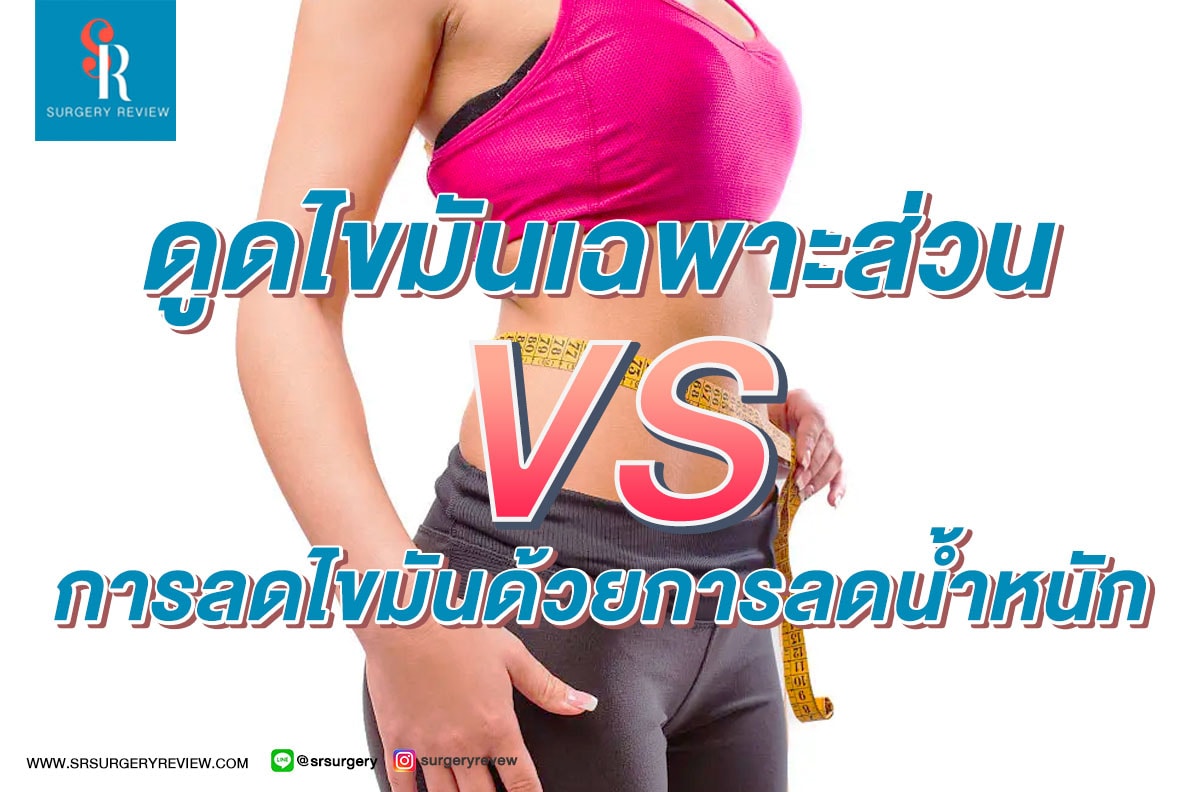 ดูดไขมันเฉพาะส่วน