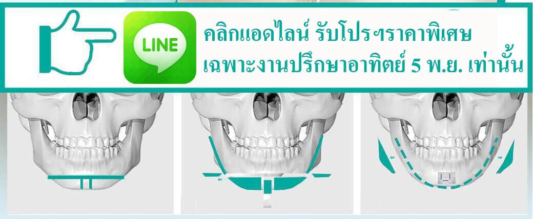 รัปโปรและราคาพิเศษ-งานปรึกษาอาทิตย์นี้