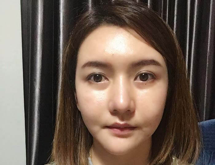 คุณนุ่นก่อนทำศัลยกรรมเกาหลี