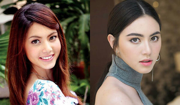 ใหม่-ฉีดสลายไขมัน-ให้หน้าเรียว