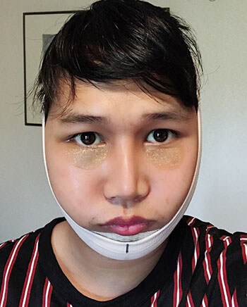 รีวิวปรับโครงหน้าผู้ชาย ความแตกต่างระหว่าง ศัลยกรรม ชาย - หญิง ที่ต้องรู้ | Surgery Review รีวิวปรับโครงหน้าผู้ชาย ความแตกต่างระหว่าง ศัลยกรรม ชาย - หญิง ที่ต้องรู้ | Surgery Review