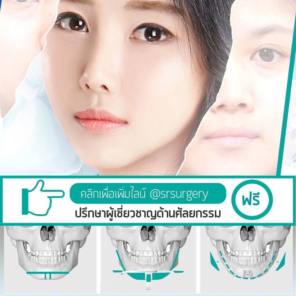 ปรึกษาผู้เชี่ยวชาญด้านศัลยกรรม-srsurgery