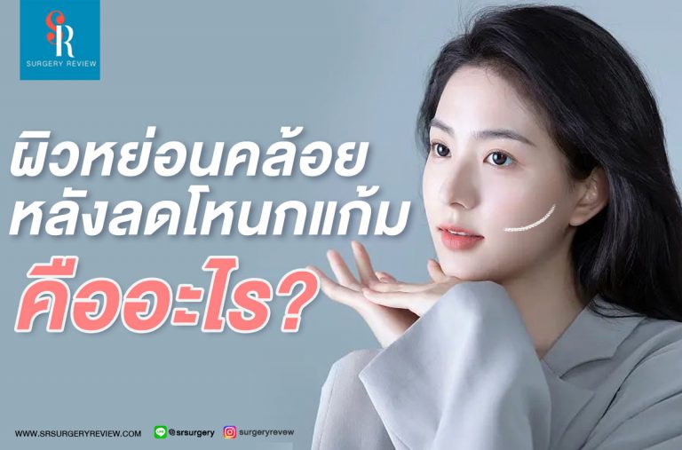 ผิวหย่อนคล้อยหลังลดโหนกแก้ม