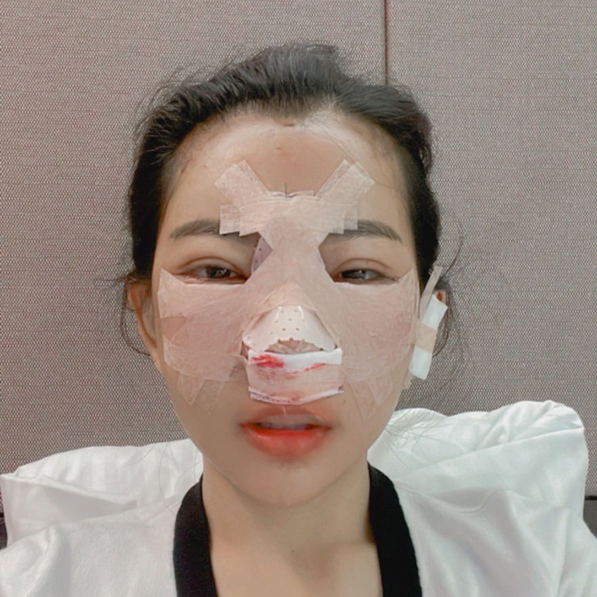 รีวิวคุณกุ๊ก ศัลยกรรมเกาหลี วันที่ 12