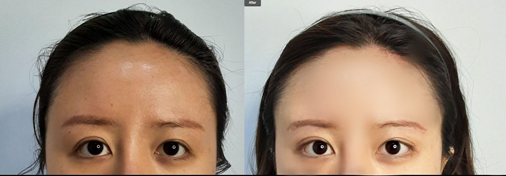 ผลงานและรีวิวของ ONLIF Plastic Surgery 02