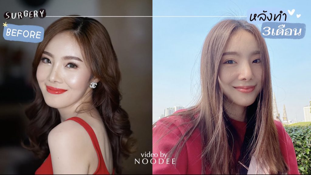 ผ่านไป 3 เดือน