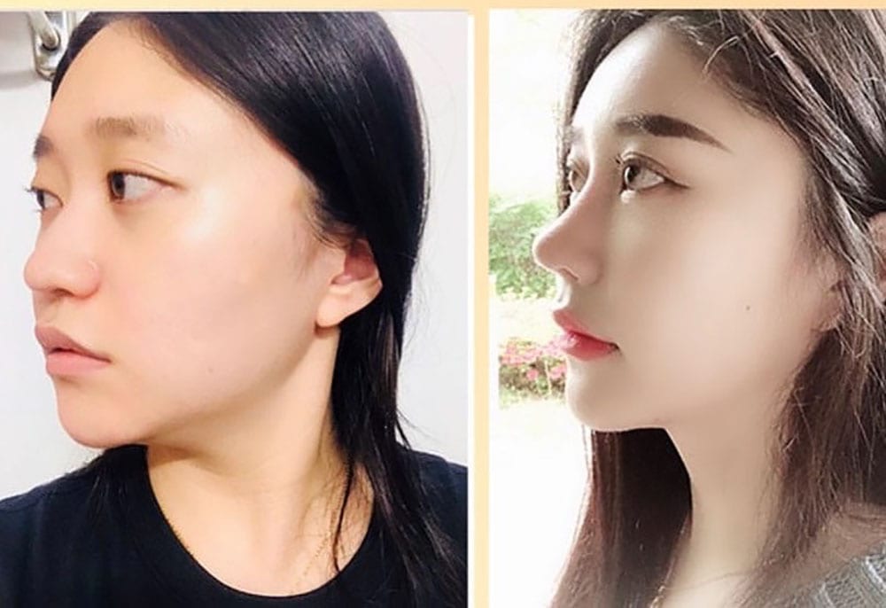 รีวิว Top Class Plastic Surgery 01