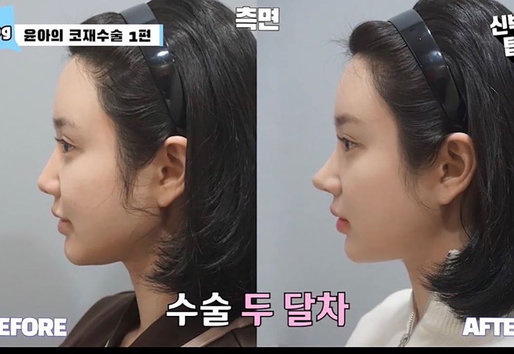 รีวิว Top Class Plastic Surgery 03