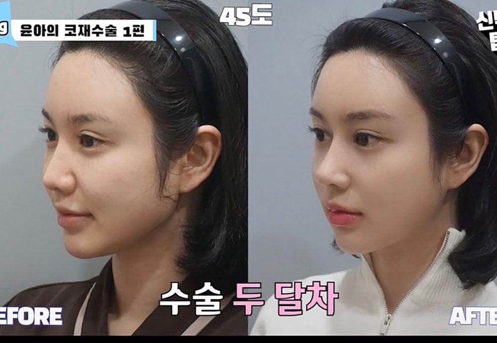 รีวิว Top Class Plastic Surgery 04