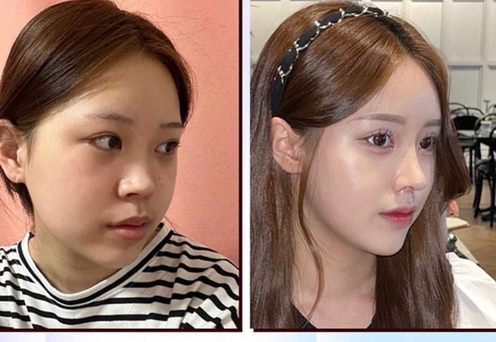 รีวิว Top Class Plastic Surgery 06