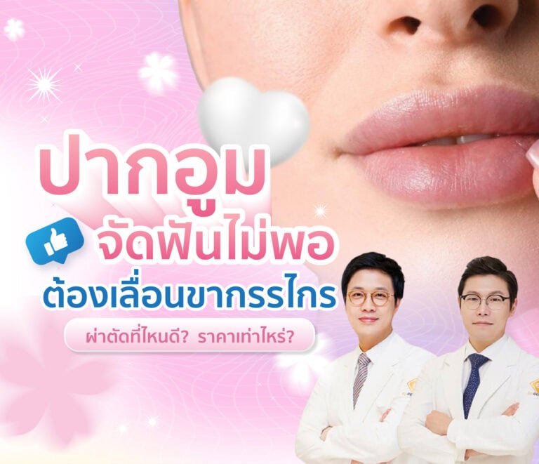 ปัญหาปากอูม