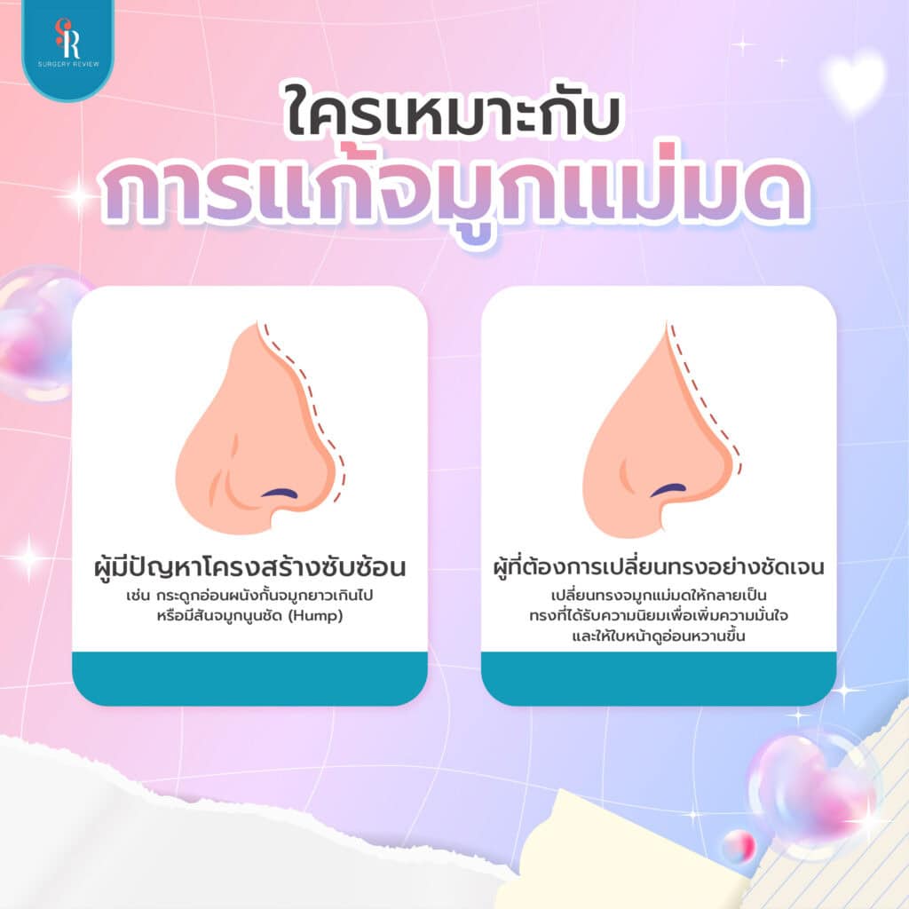 การแก้จมูกแม่มดเหมาะกับใคร