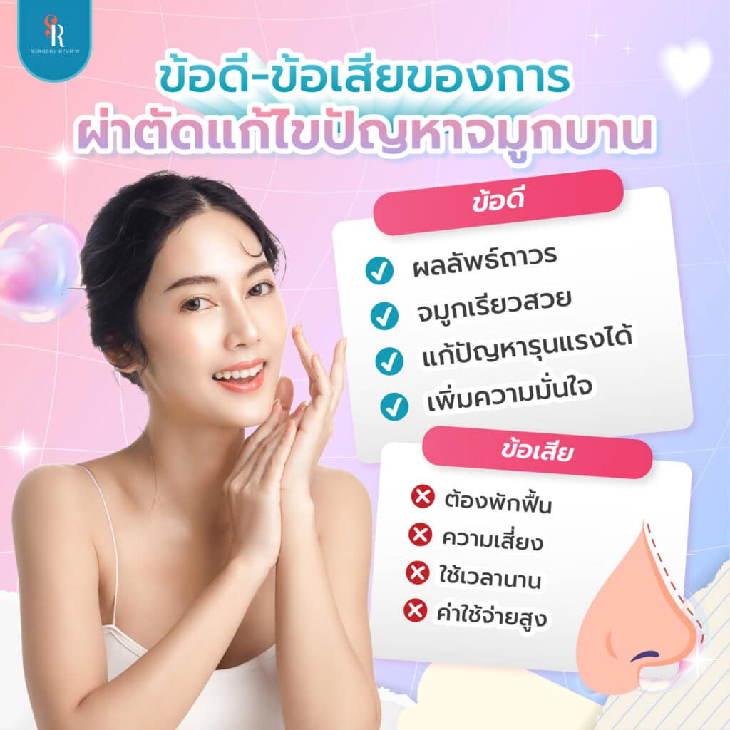 ข้อดี ข้อเสีย ของการเสริมจมูก แก้จมูกบาน