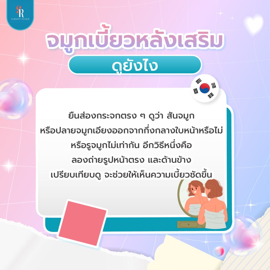 จมูกเบี้ยวหลังเสริมจมูก สังเกตอย่างไร