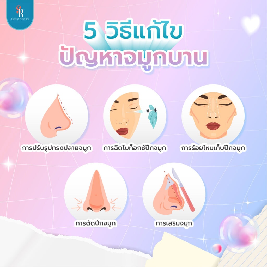 วิธีแก้ปัญหาจมูกบาน