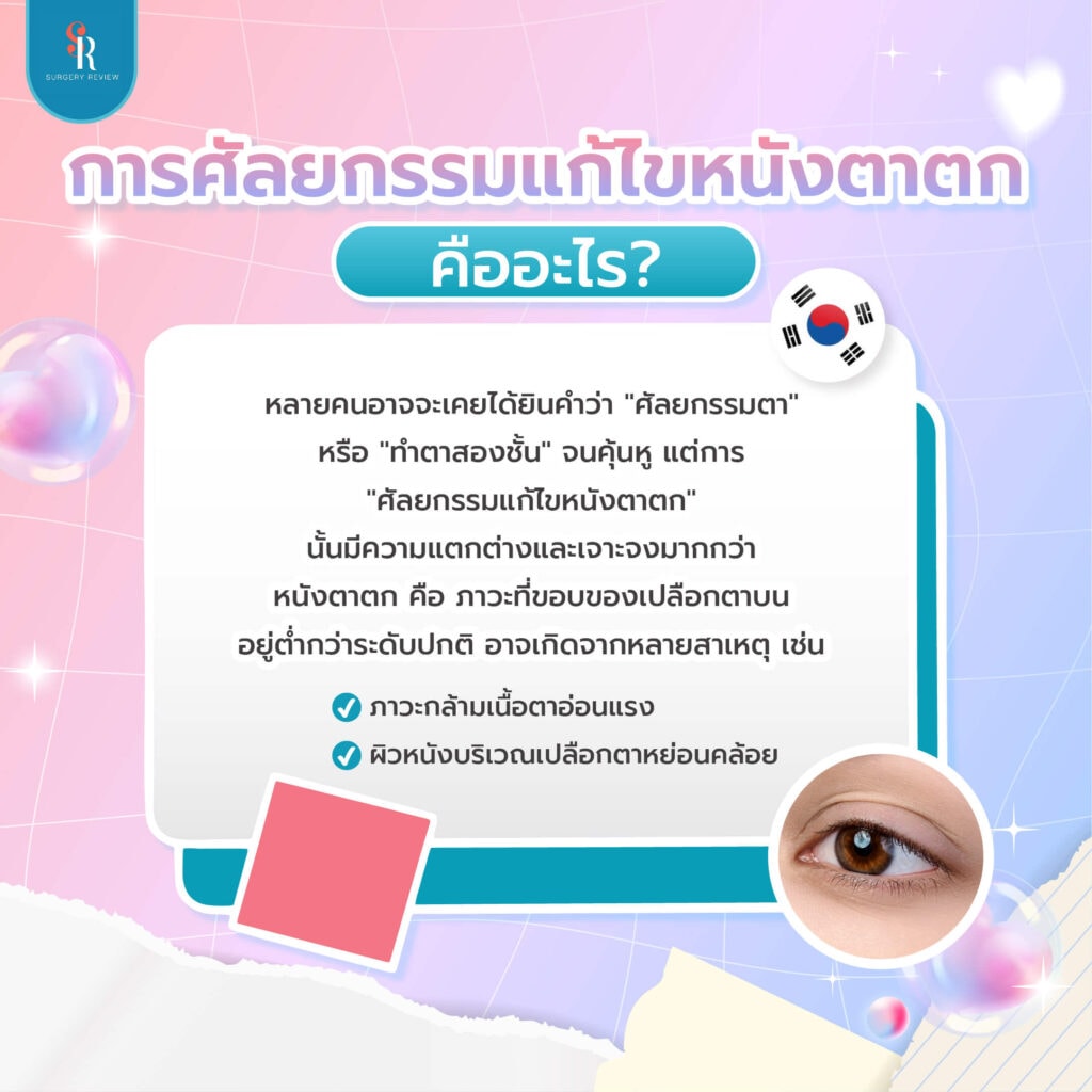 การศัลยกรรมแก้ปัญหาหนังตาตก คืออะไร