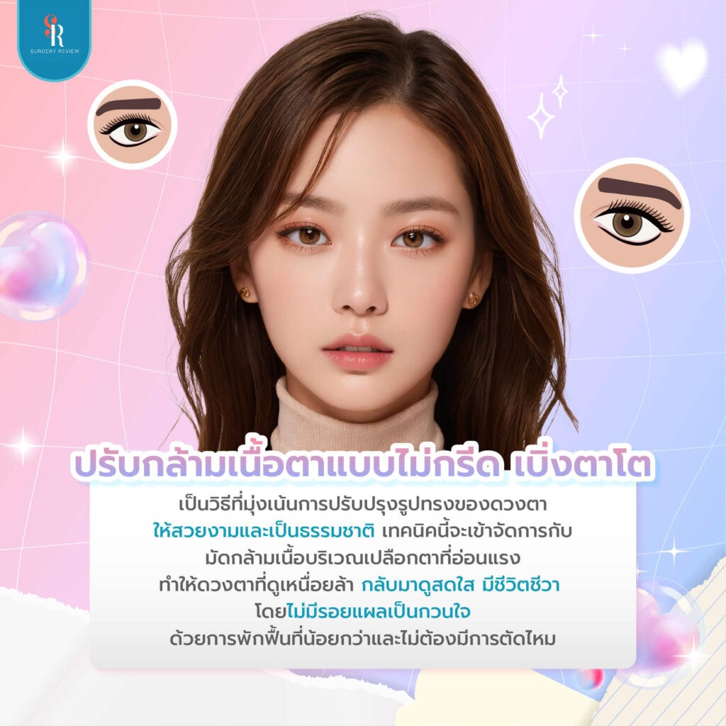 ปรับกล้ามเนื้อตาแบบไม่กรีด