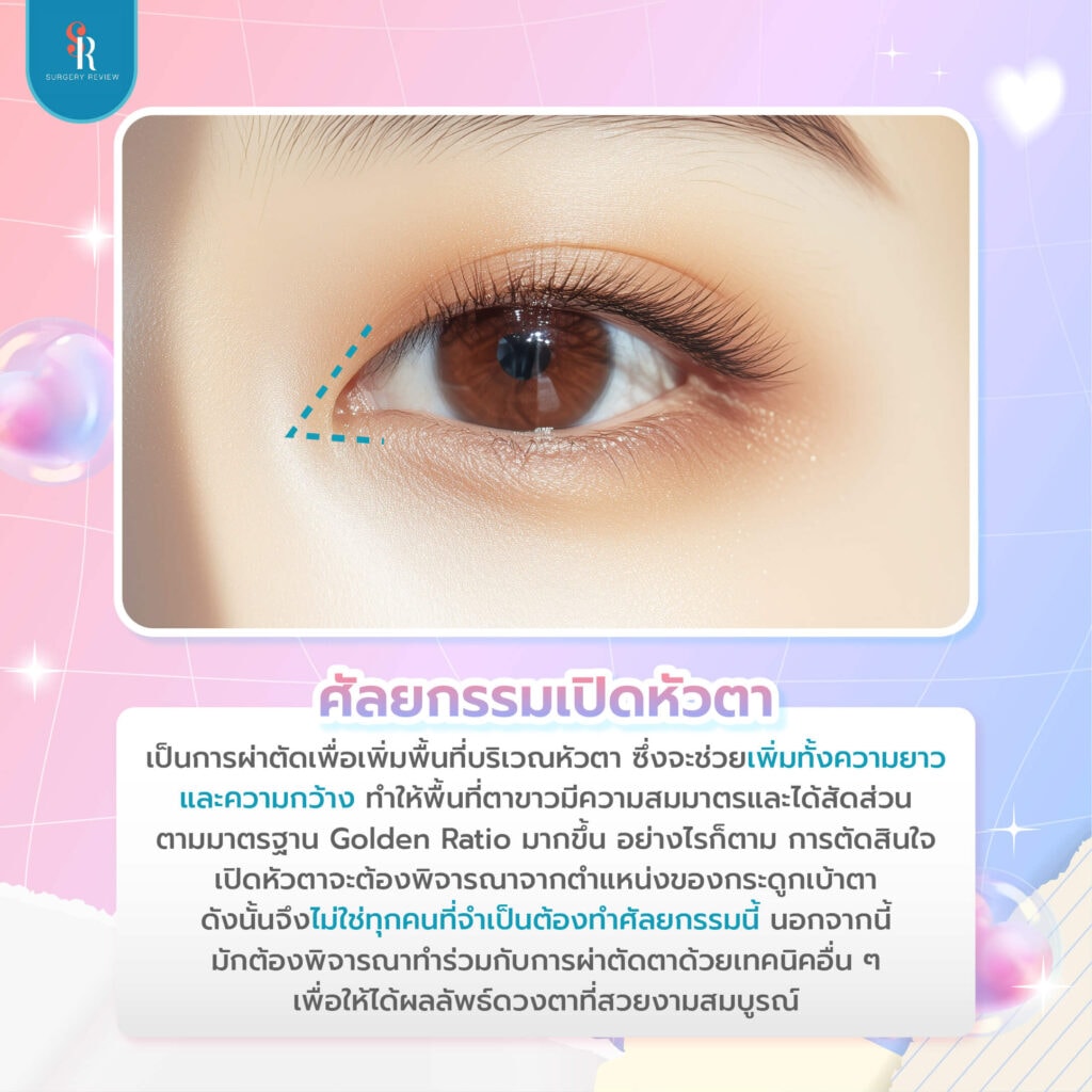 ศัลยกรรมเปิดหัวตา