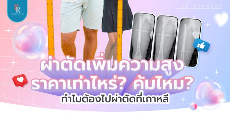 ผ่าตัดเพิ่มความสูง ราคาเท่าไหร่