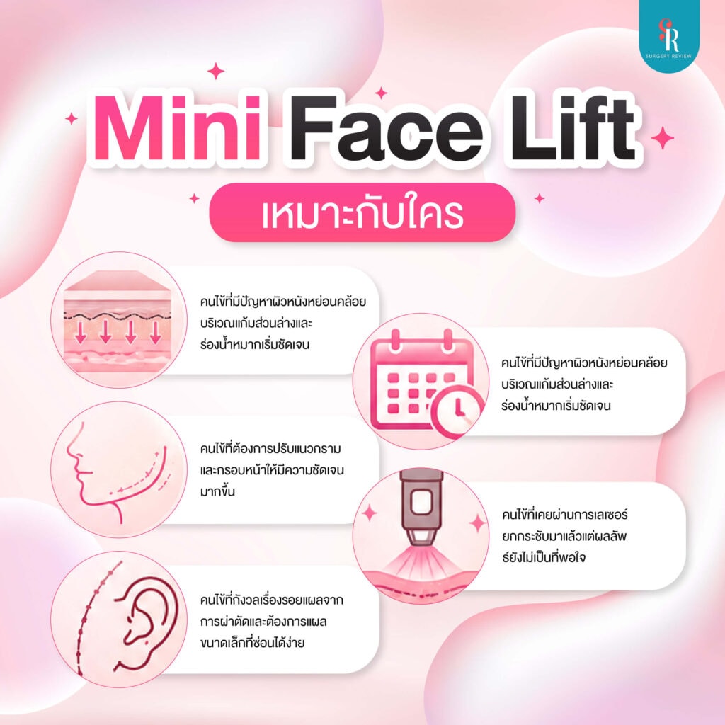mini face lift ใครควรทำ