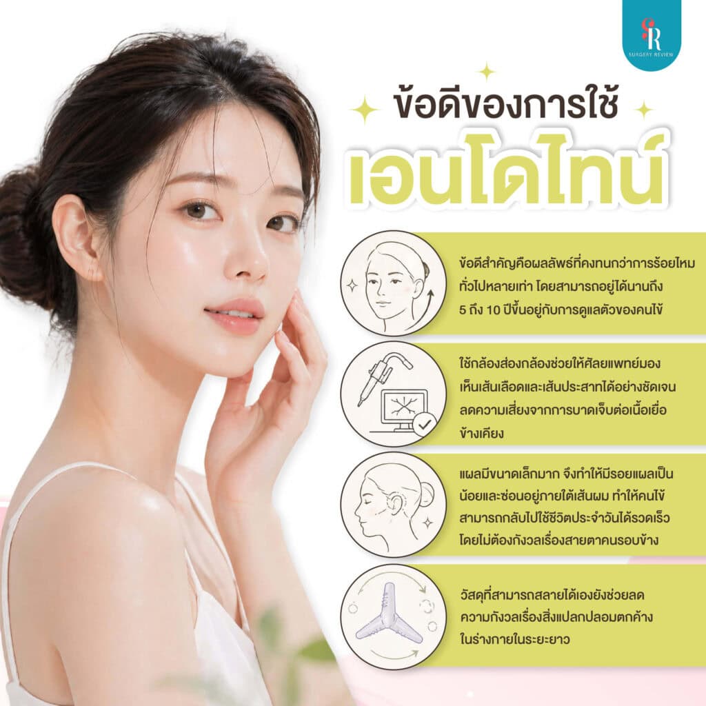 ข้อดีของการทำเอนโดไทน์