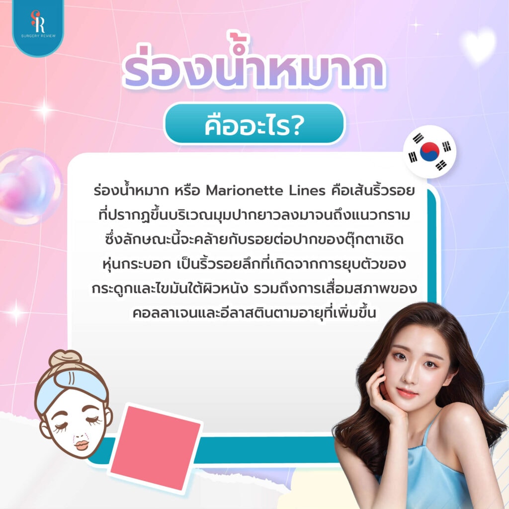 ร่องน้ำหมาก คือ
